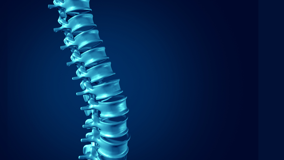 Something New and Important From an Original IDE RCT On Cervical Disc Arthroplasty