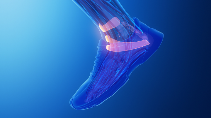 ICYMI: The Best Info We’ve Got on Return to Sport After Lateral Ankle Ligament Surgery